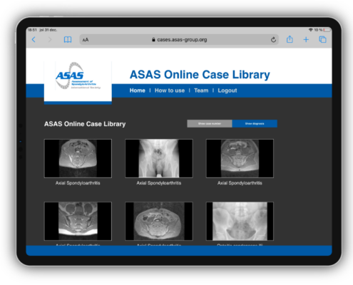 ASAS Online Case Library on an iPad.
