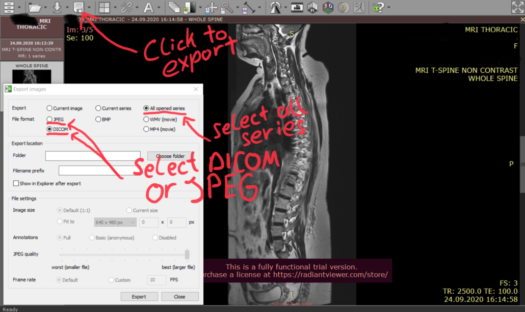 exporting images with RadiAnt DICOM